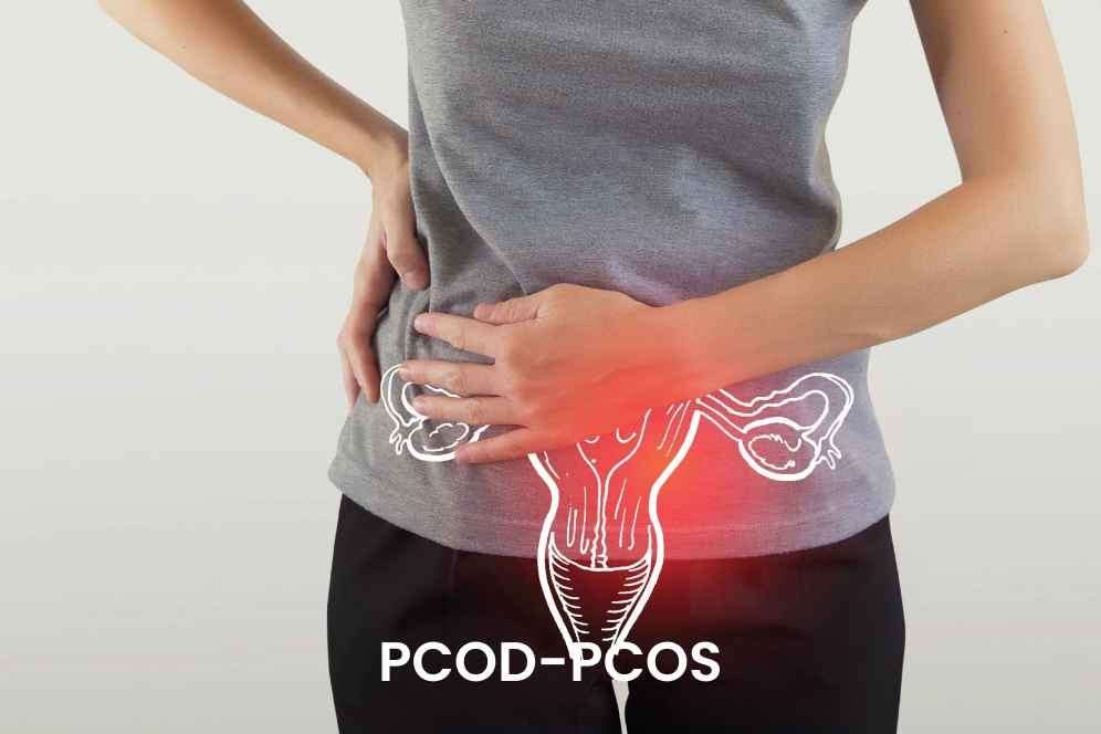 PCOD Treatment