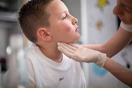 Skin Diseases Treatment